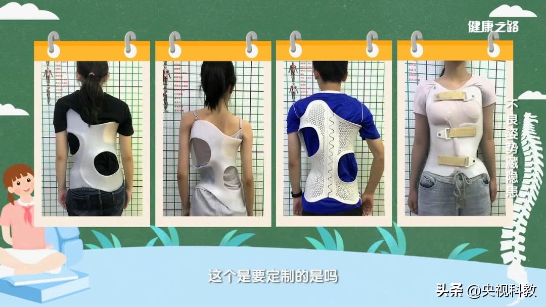 小孩驼背怎么矫正过来,孩子驼背可以按回去吗