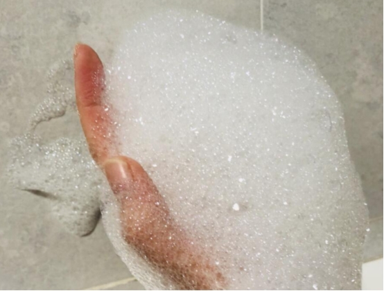 30年前的虱子现在怎么消失了,30年前人为什么都有虱子