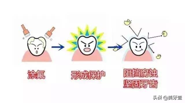 蛀牙前期怎么防止恶化,早期蛀牙怎么处理比较好