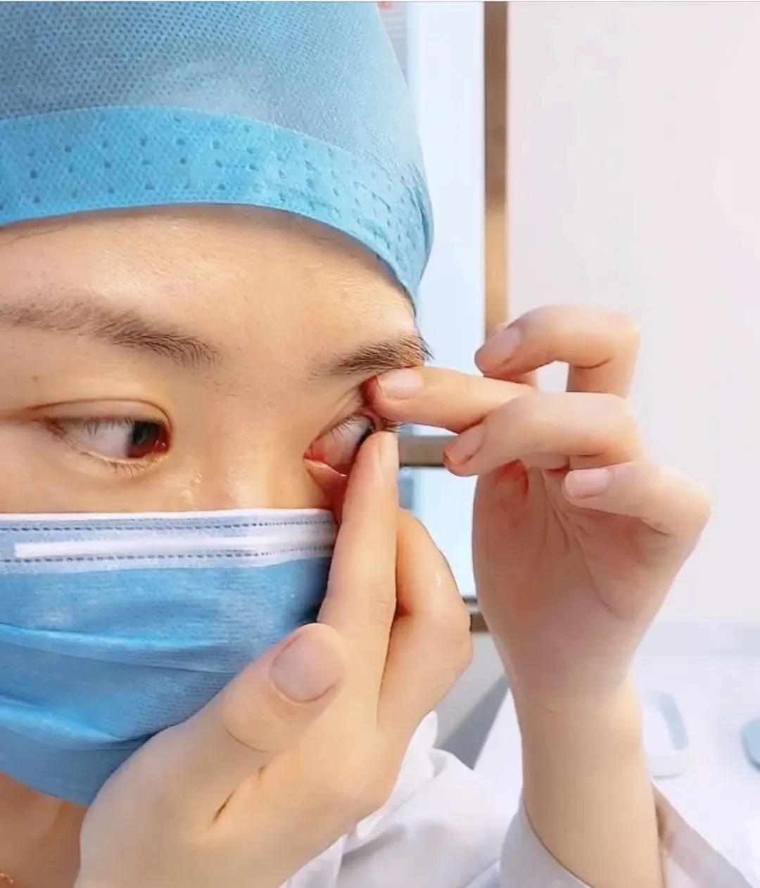 隐形应该怎么摘,专业方法在这里