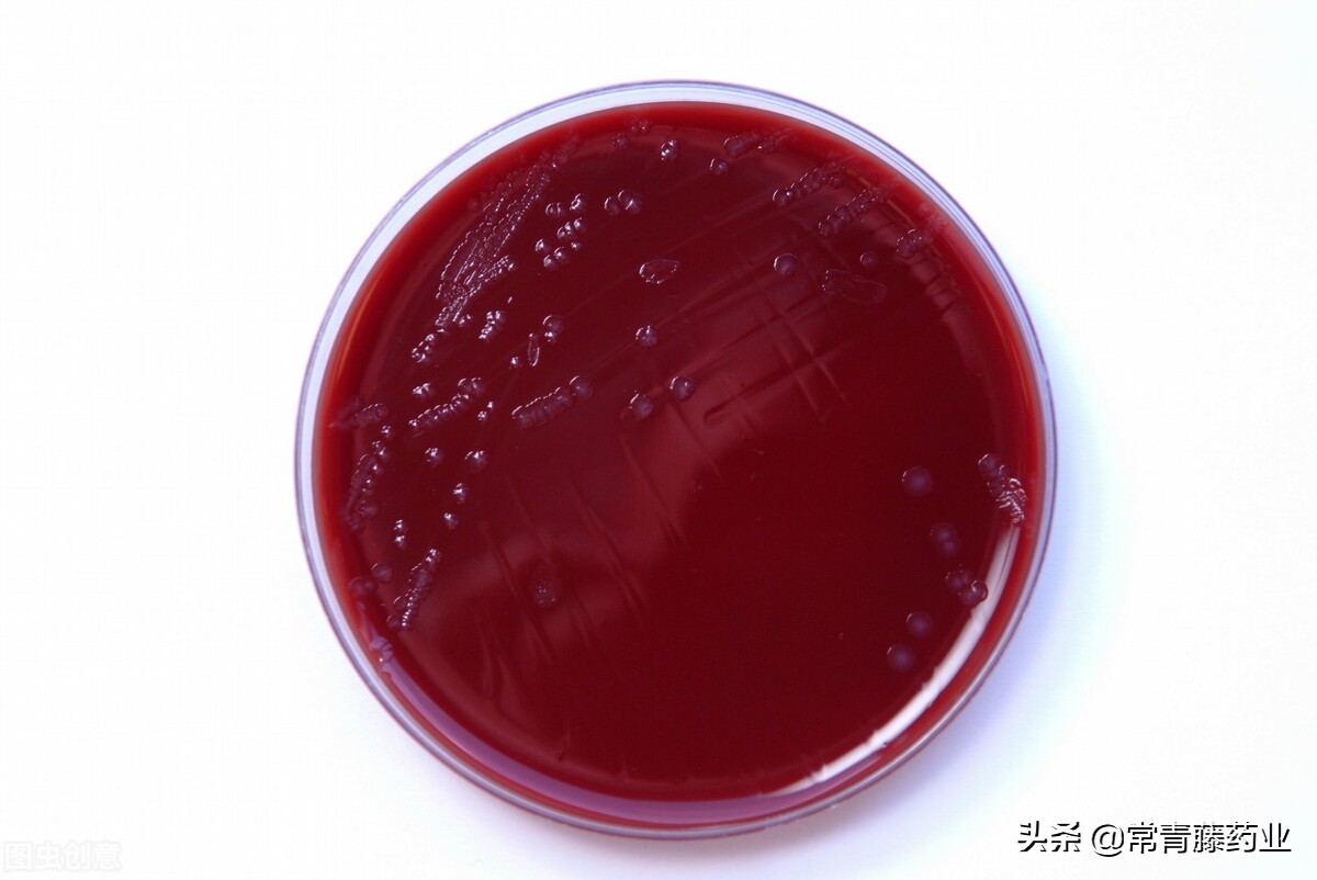 淋病检查注意什么,淋病应该去什么科室检查