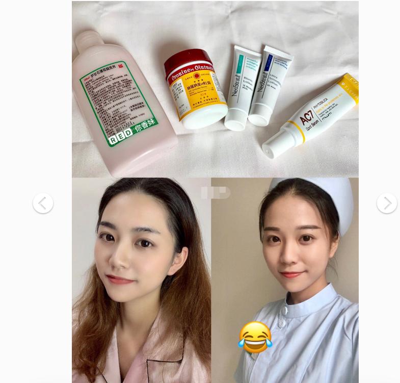 祛痘医学用品,便宜的祛痘用品