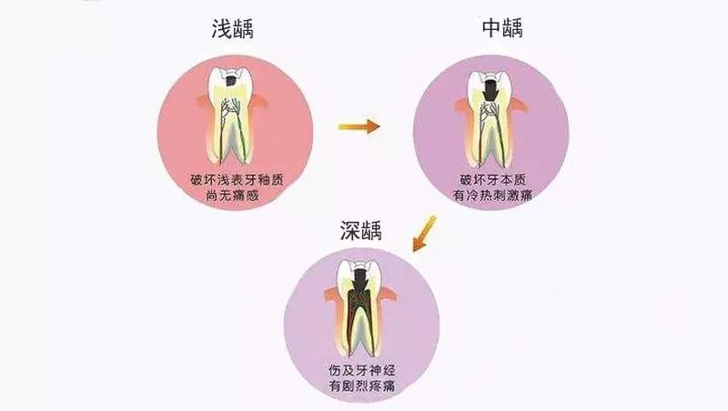 牙髓炎自愈的可能性,牙髓炎有办法自愈吗