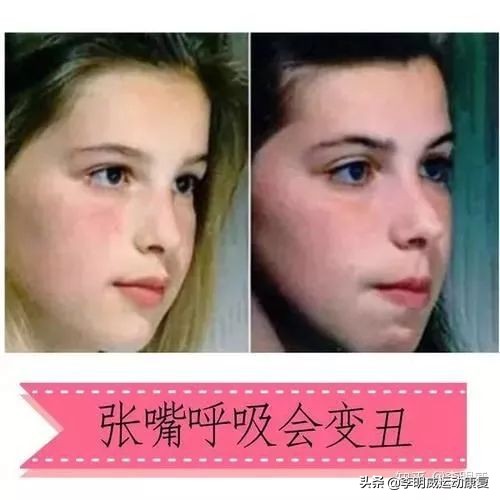 新生儿大小脸怎么矫正,教你如何矫正大小脸