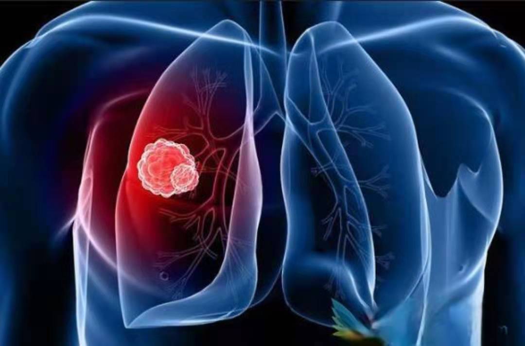 儿童丧失视力，或许是视网膜母细胞瘤在作祟，治疗方法有哪些？