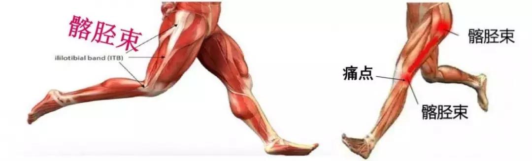 跑步大腿疼和小腿疼有什么区别,跑步之后脚跟疼怎么回事