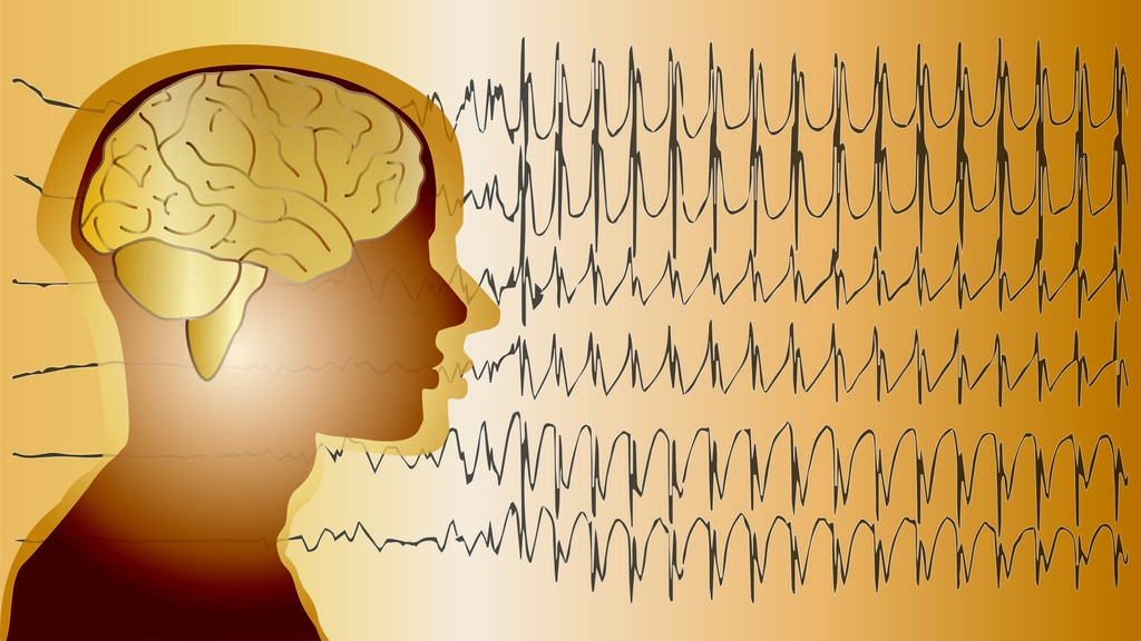 癫痫病发作症状有哪些,小孩癫痫病发作的症状