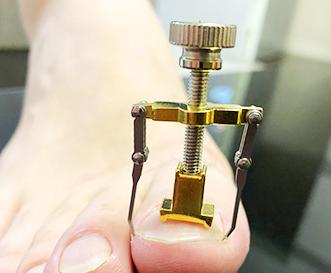 脚的10大症状图片,脚最容易得这8种病