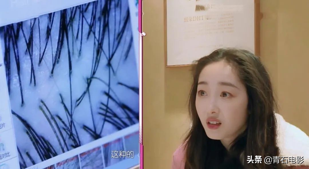 明星蒋梦婕,蒋梦婕我家那闺女植发片段