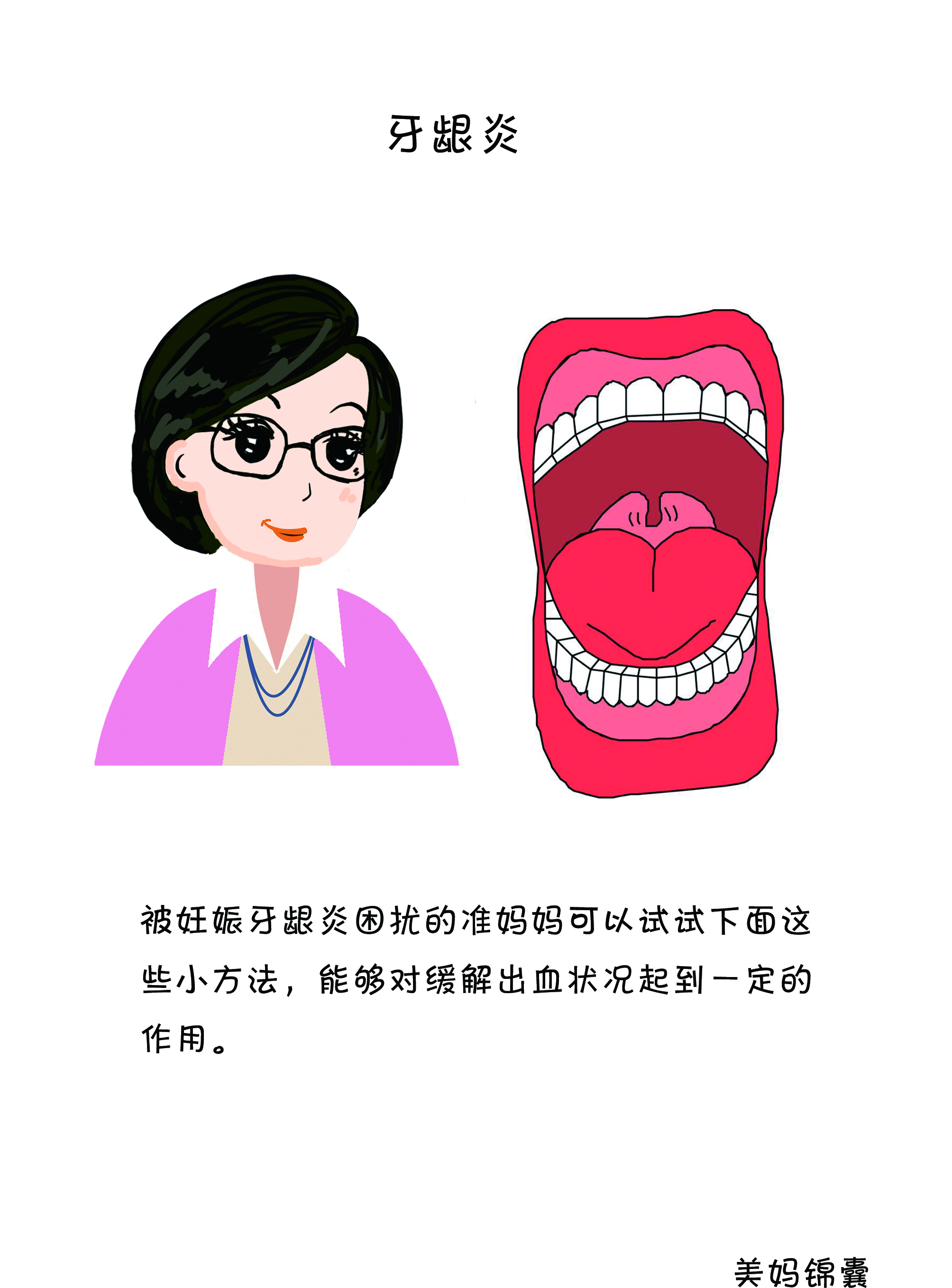 孕期牙龈炎怎么办,孕期牙龈炎使用什么牙膏