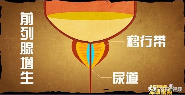 尿不爽,尿不臭是怎么回事