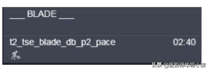 心脏mr增强扫描讲解,磁共振心脏扫描标准切面