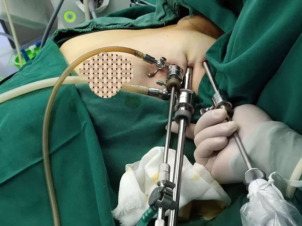 长治市第二人民医院激光手术,长治市第二人民医院外科