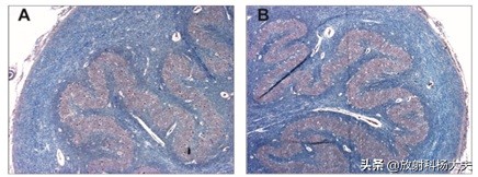 放射科趣味图片,放射科亮点图片