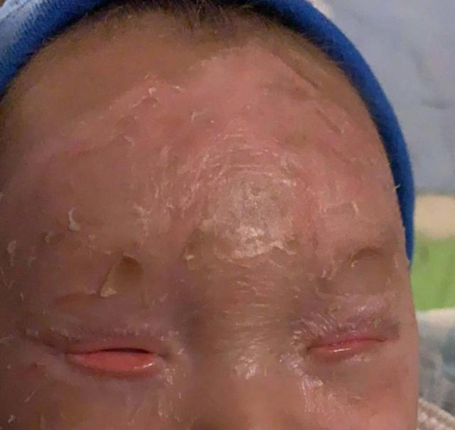 走近罕见病群体,专家呼吁让更多人了解罕见病