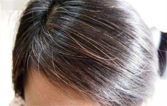 木北护肤正规吗,木北造型与木北护肤造型区别