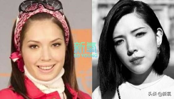 盘点整容后不敢认的女星颜值巅峰,知名女网红被扒整容
