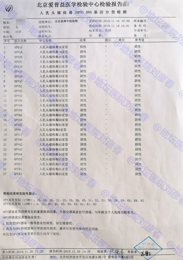 微创热凝杀毒剥脱术是什么手术,微创热凝杀毒剥脱术价格