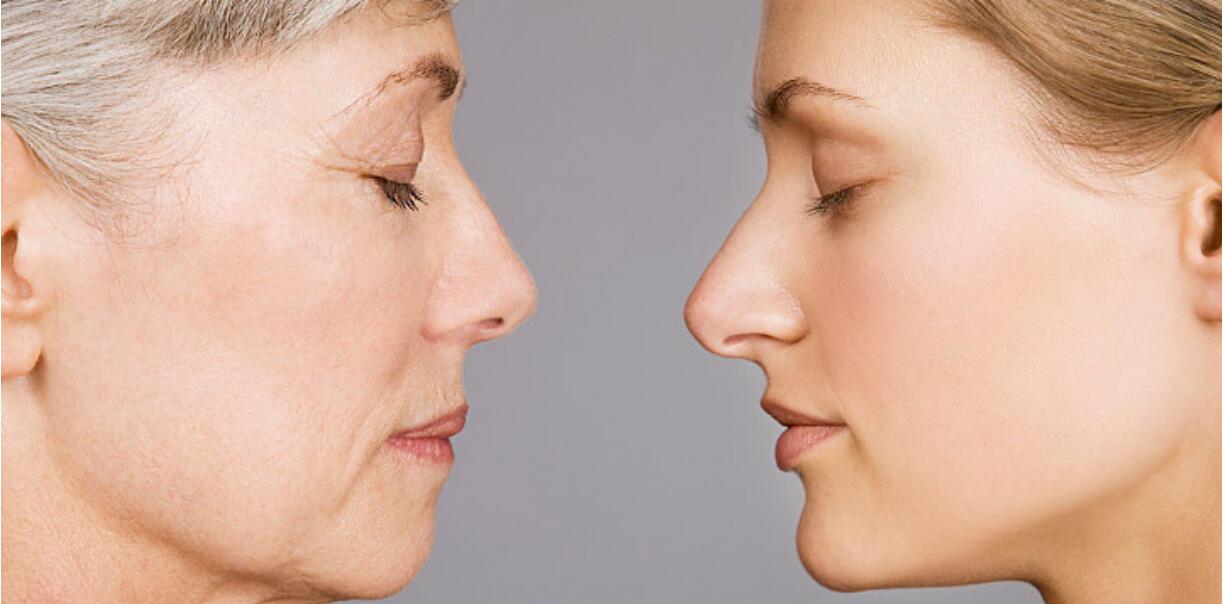 鼻整形五十年后,鼻整形修复三次