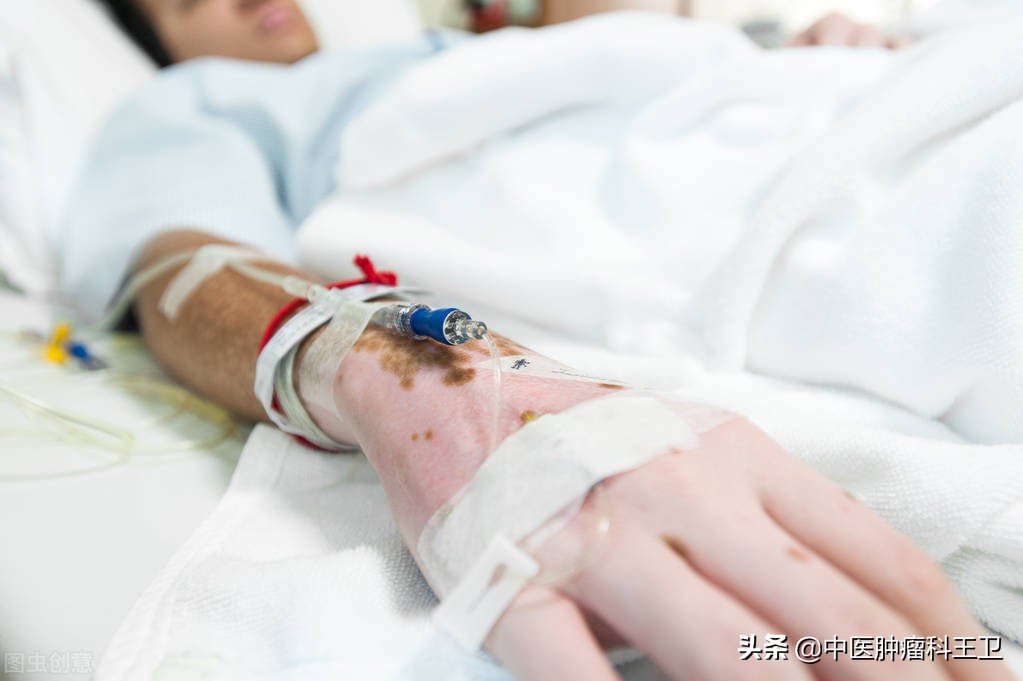 癌症复发预防,癌症复发较难治坚持做好3件事