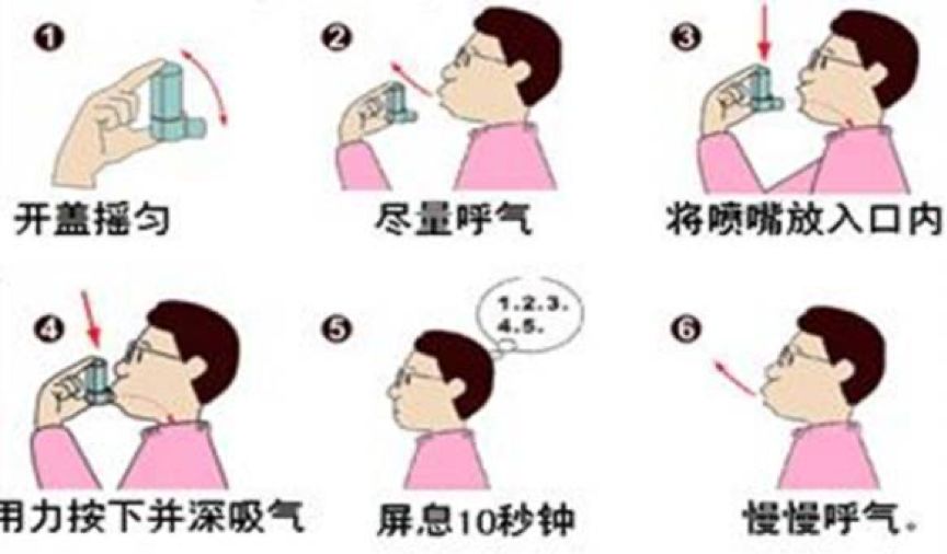 哮喘药物喷雾剂吸入后漱口,哮喘雾化吸入后可以直接漱口吗