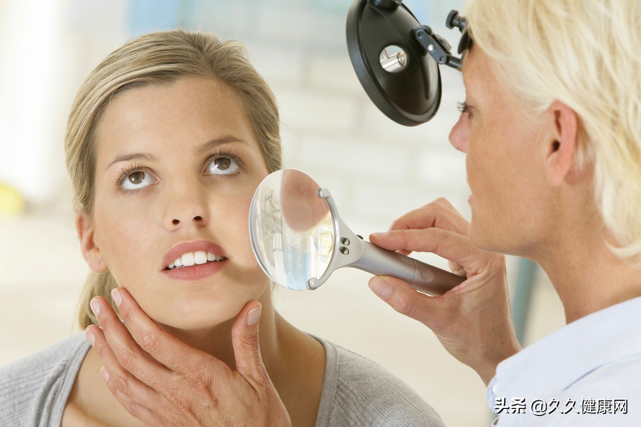 脸上有红血丝怎么修复小窍门,脸上泛红有红血丝该用什么护肤