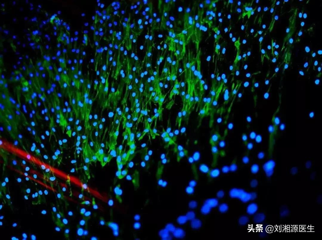 免疫不良妊娠诊断为不孕,免疫相关不良妊娠解释