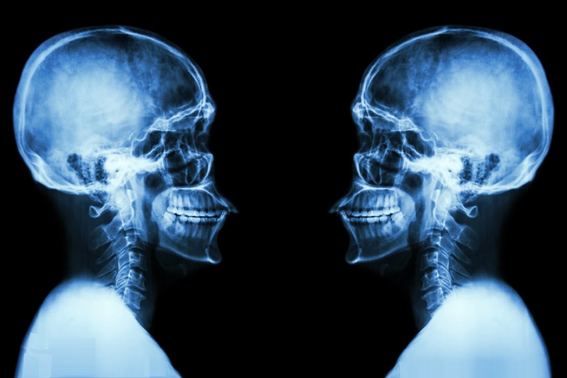 什么是x射线y射线,什么是x射线检测