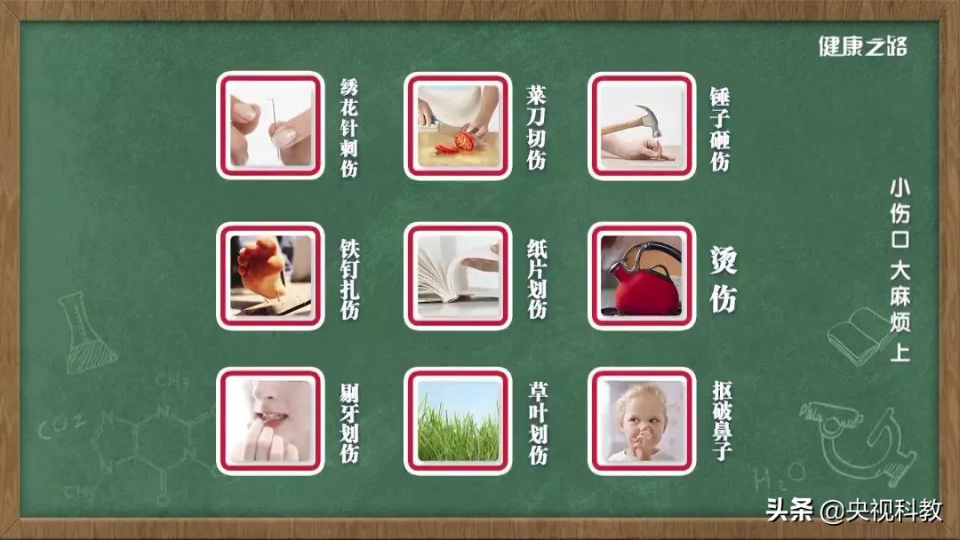 一根钉子造成的惨剧,铁钉破伤风怎么处理