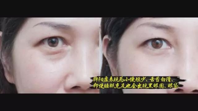 经常晚上拉肚子是什么原因,拉肚子眼圈变黑怎么回事