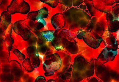 为什么补充蛋白质会提高免疫力,合理补充蛋白质能提高人体免疫力