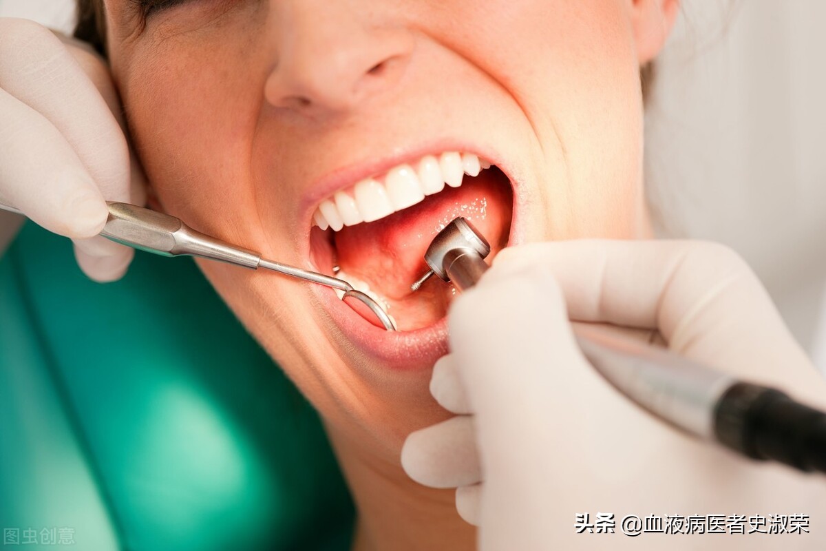 再障牙龈老流血咋办,最近刷牙牙龈总是出血是怎么回事