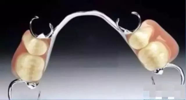 磨牙齿掉了一颗能整牙吗,磨掉两边的牙镶牙好吗能用多久