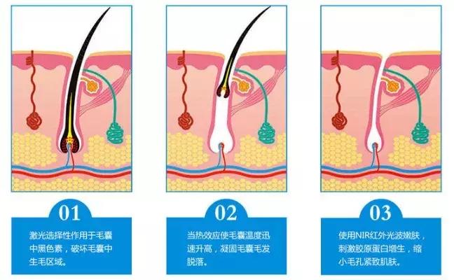夏天到了，可不能继续当个“毛”女孩！