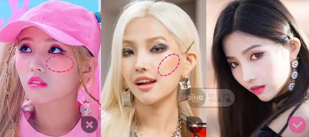 戴牙套凸嘴怎么化妆,凸嘴整牙削骨吗