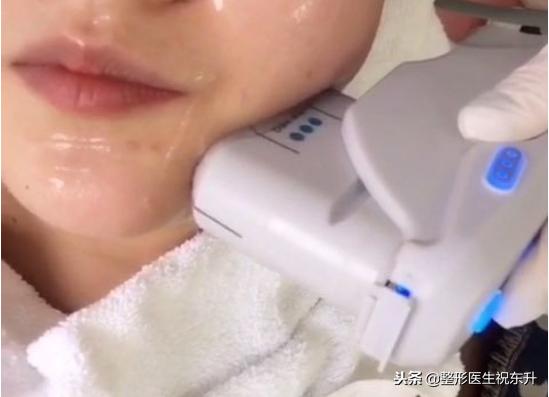 刚做完超声刀感觉脸有点肿正常吗,做完超声刀后脸肿了是正常现象吗