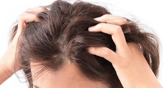 去屑的小技巧,去屑真正有效的方法