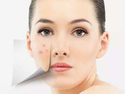 额头上长痘的原因和治疗方法,额头反复长痘的缓解方法