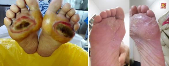 无精症患者的新希望,卵巢癌最新治疗新希望