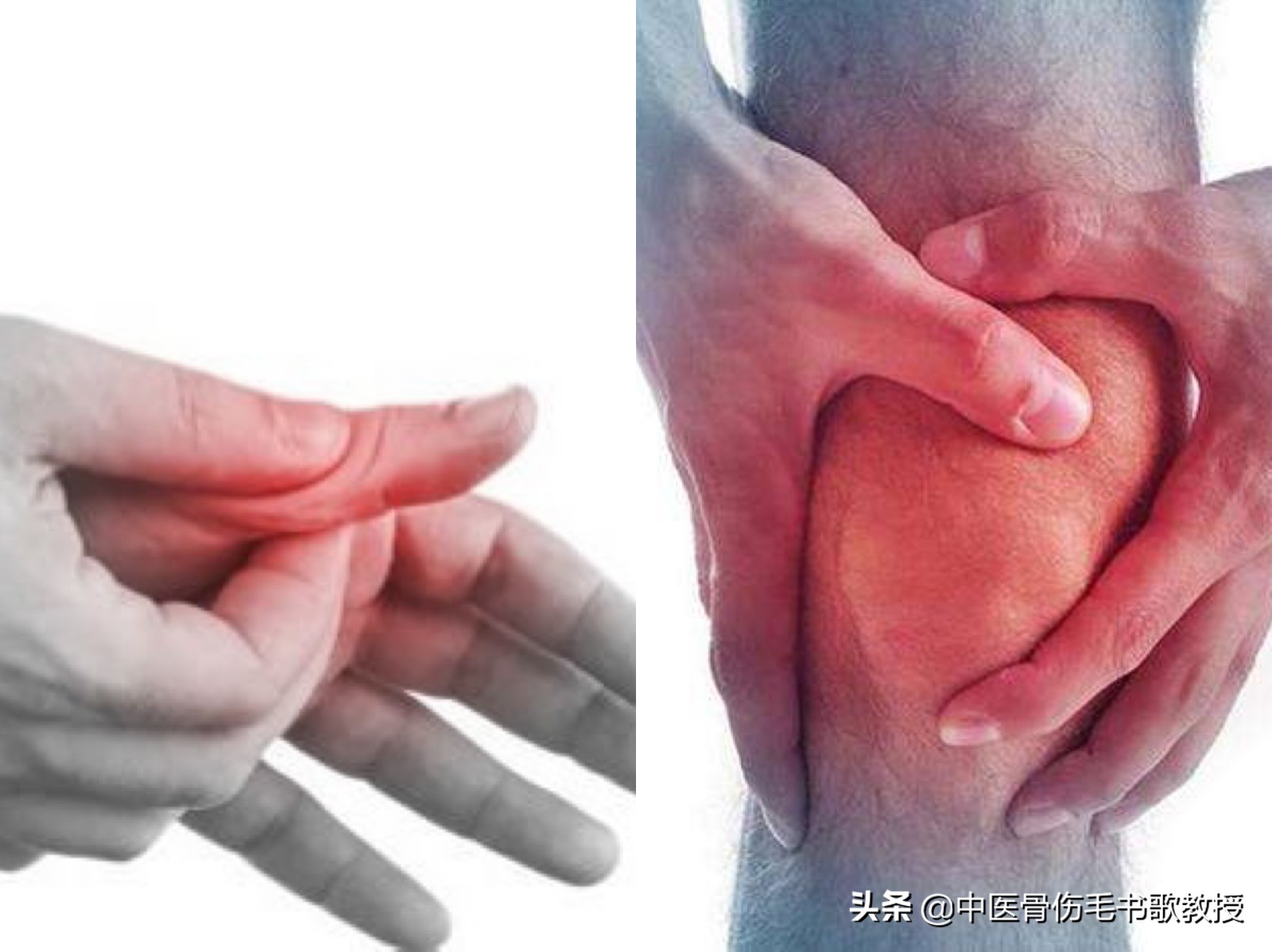 手指关节痛属于风湿还是类风湿,手指关节僵硬膝盖都疼是什么病兆