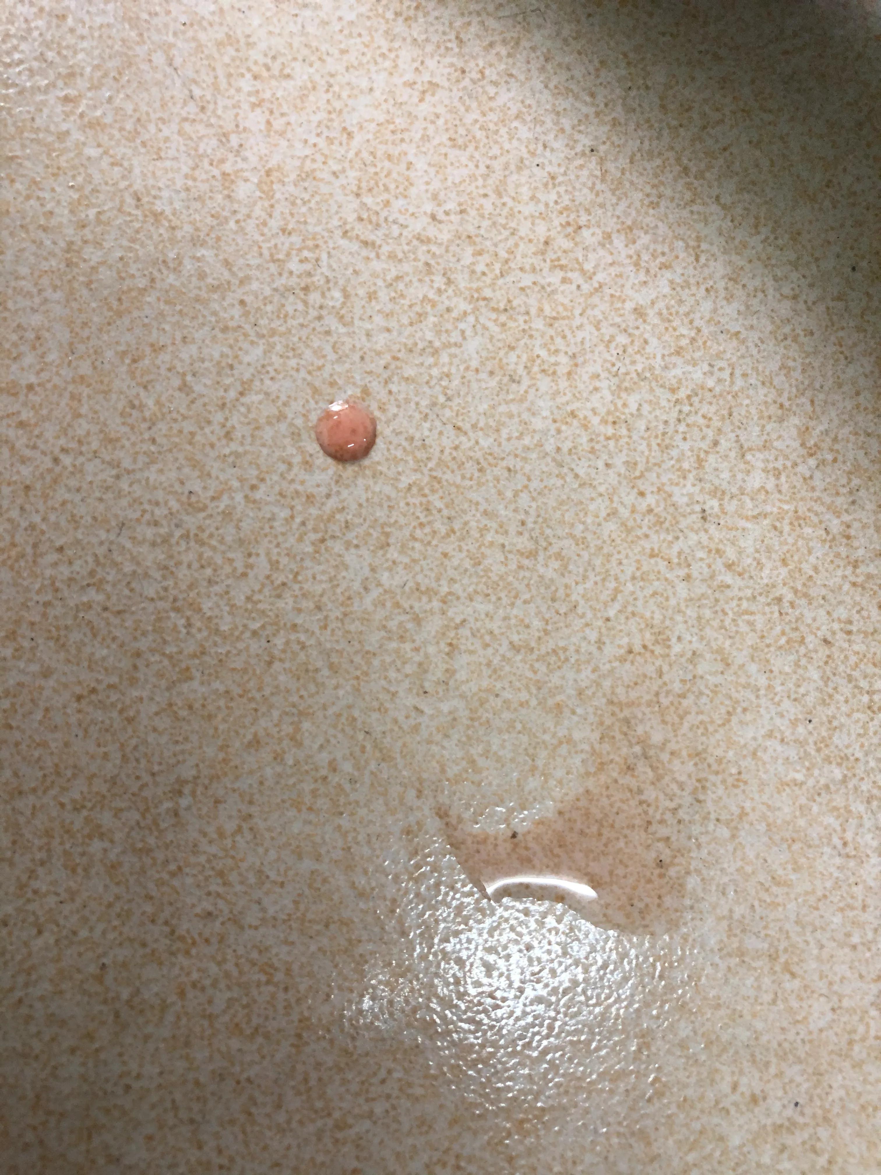 猫咪尿血尿闭住院,猫咪反复尿闭怎么治