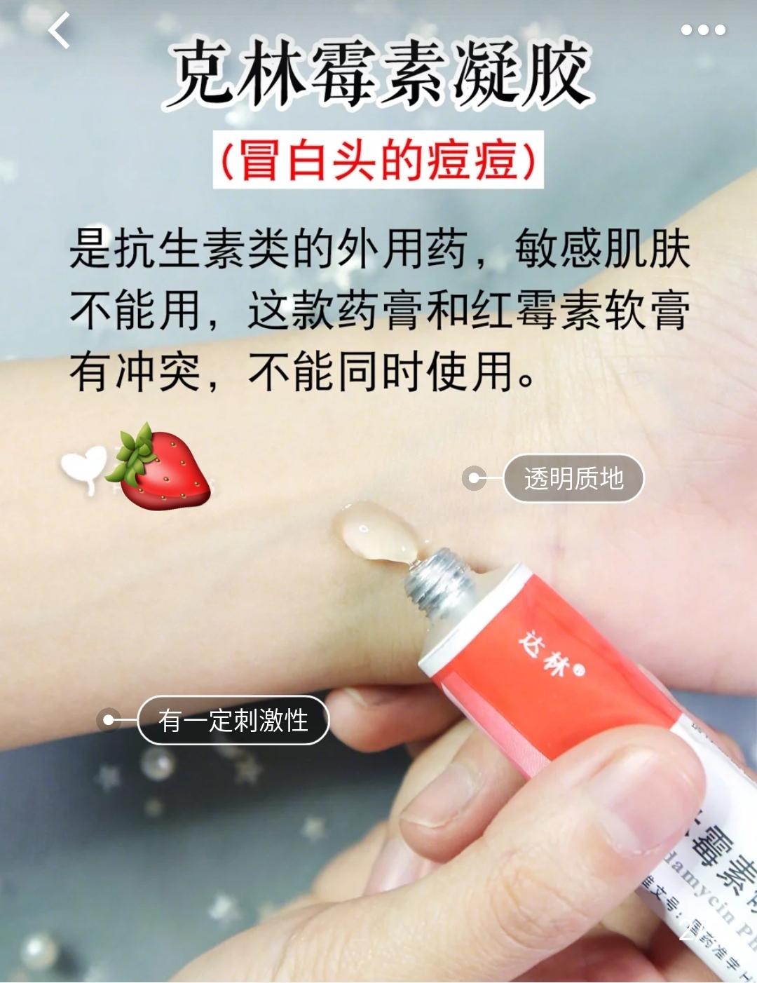 干货！皮肤科护士推荐-7只祛痘药膏，快速祛除痘痘黑头酒糟鼻