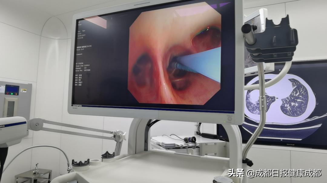 肺腺癌有被攻克的可能吗,检查竟然是肺癌这个病极为凶险