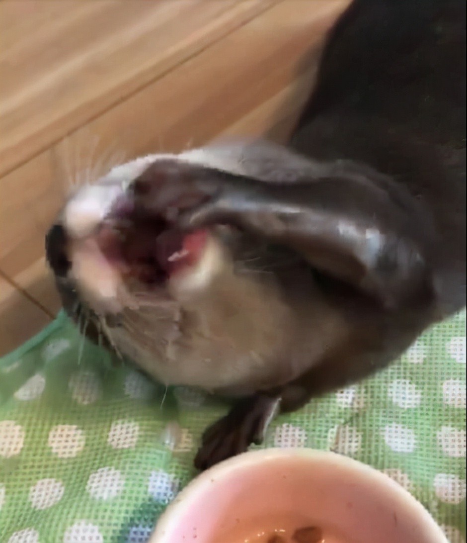 杭州牙齿龅牙矫正,牙齿矫正记录隐适美