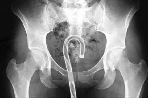 不作死就不会死看看你中了几条,不作死就不会死让人看的头皮发麻