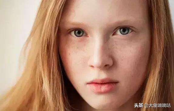 土豆片祛斑淡斑有奇效,淡斑祛斑护肤品或精油