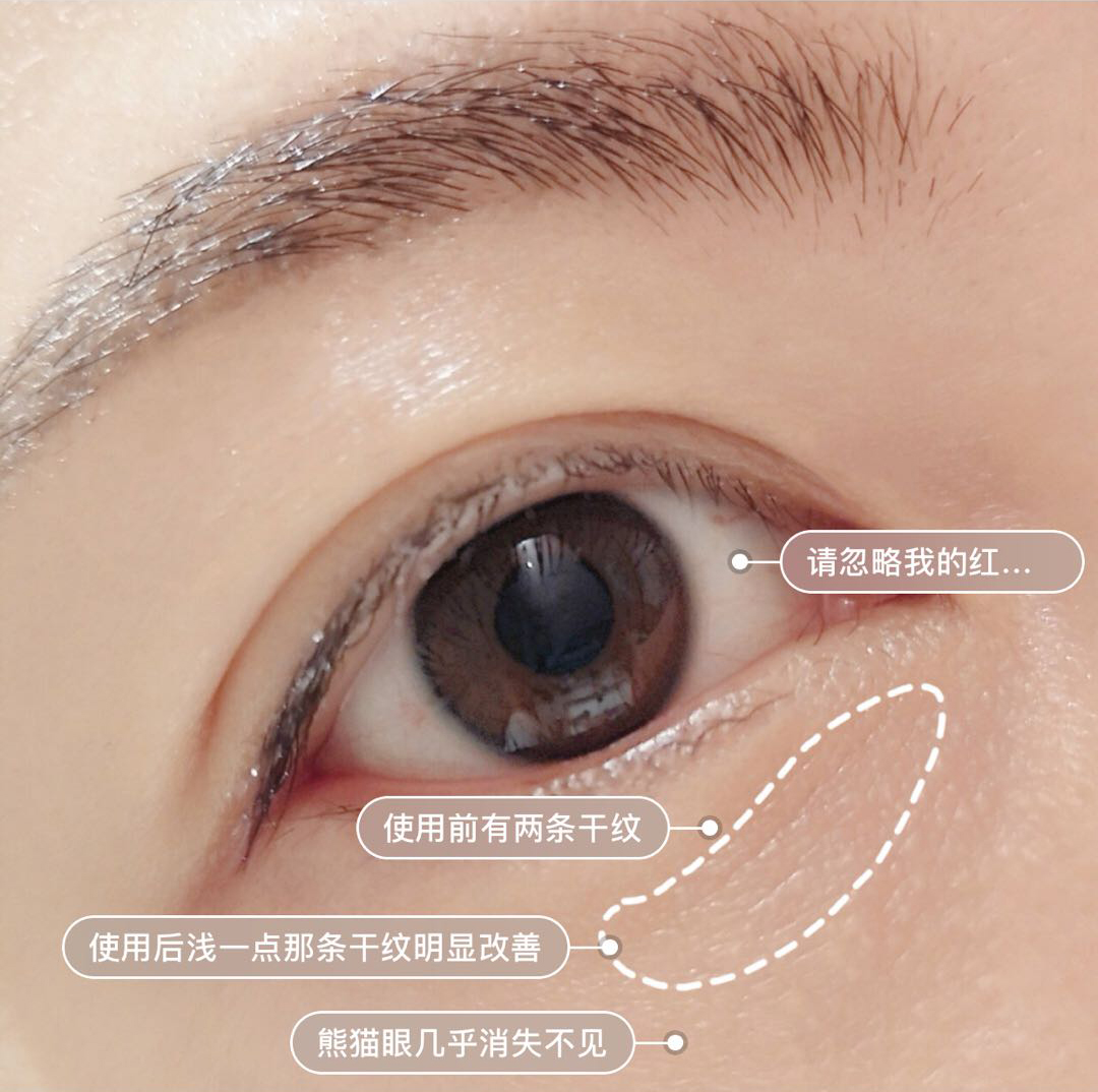 30-40岁最适合的中国眼霜,40岁以后用哪一款眼霜