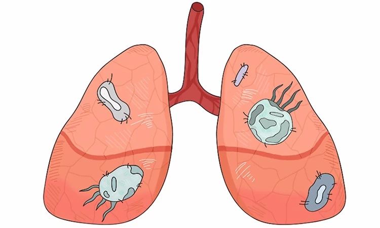 蟑螂卵都不剩的灭蟑方法,彻底消灭蟑螂老窝