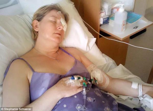 长期戴隐形眼镜眼睛里长满了溃疡,戴隐形眼镜长寄生虫前有哪些症状