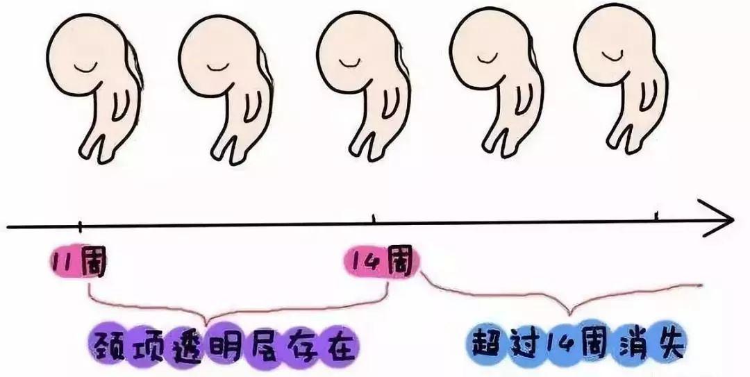 nt检查妈妈做什么运动,nt检查的孕妈妈